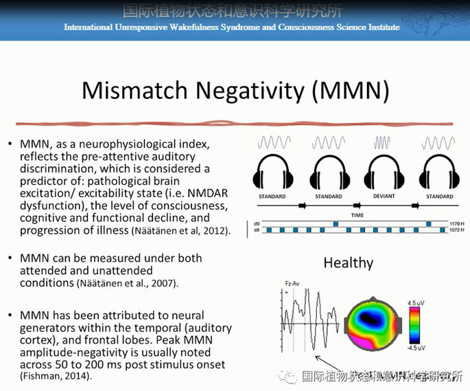 Oded Meiron & Lior Molcho：靶向前额叶的tDCS结合单通道EEG监控系统研究-千蝶医学