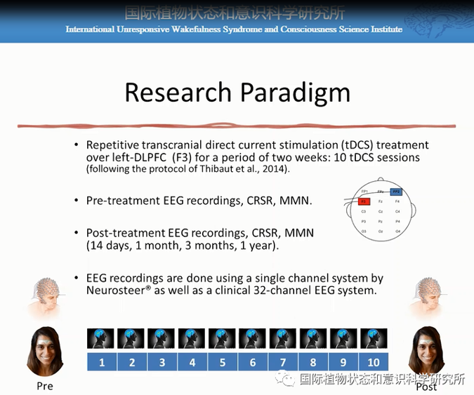 Oded Meiron & Lior Molcho：靶向前额叶的tDCS结合单通道EEG监控系统研究-千蝶医学